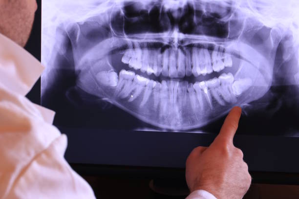 Best Dentist for Tooth Abscess  in Rosemount, OH