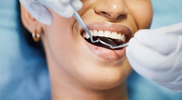 Best Urgent Tooth Repair  in Rosemount, OH